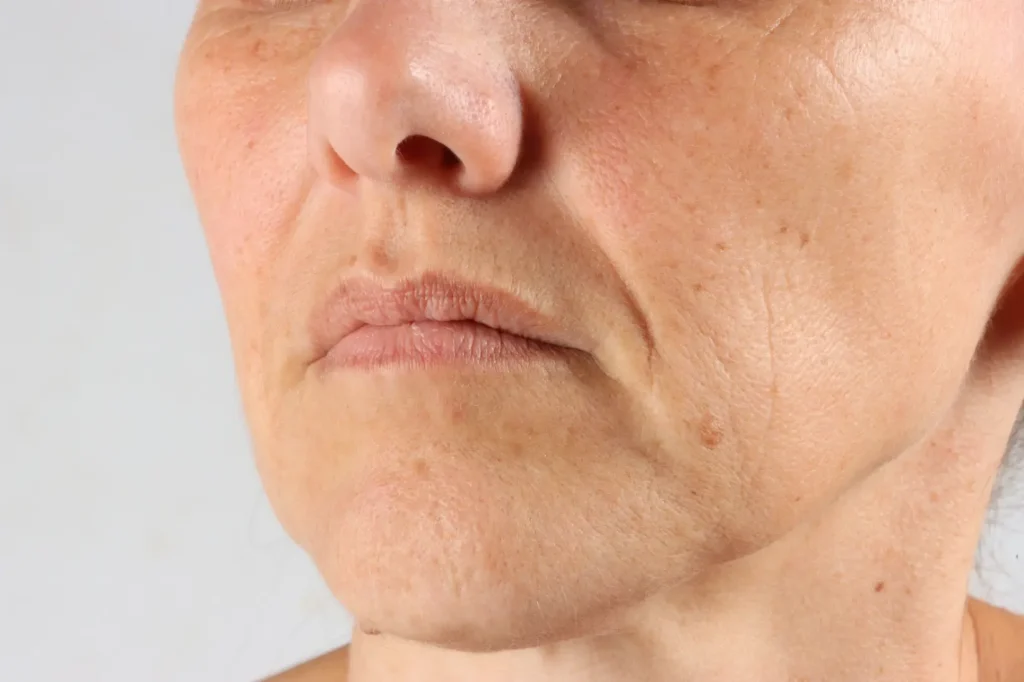 Close-up of a mature woman's lower face showing natural skin texture, fine lines, and pigmentation.